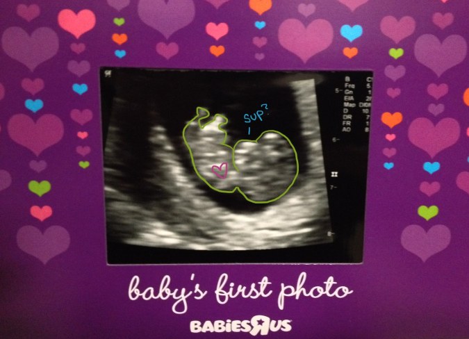 920585_10151662056950592_865308826_o